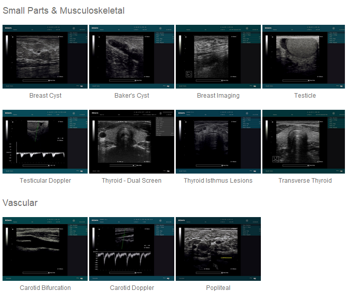 DUS 60 new compact ultrasound system