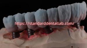 Quality Implant Supported Zirconia Bridge With Titanium Abutment High Esthetics wholesale
