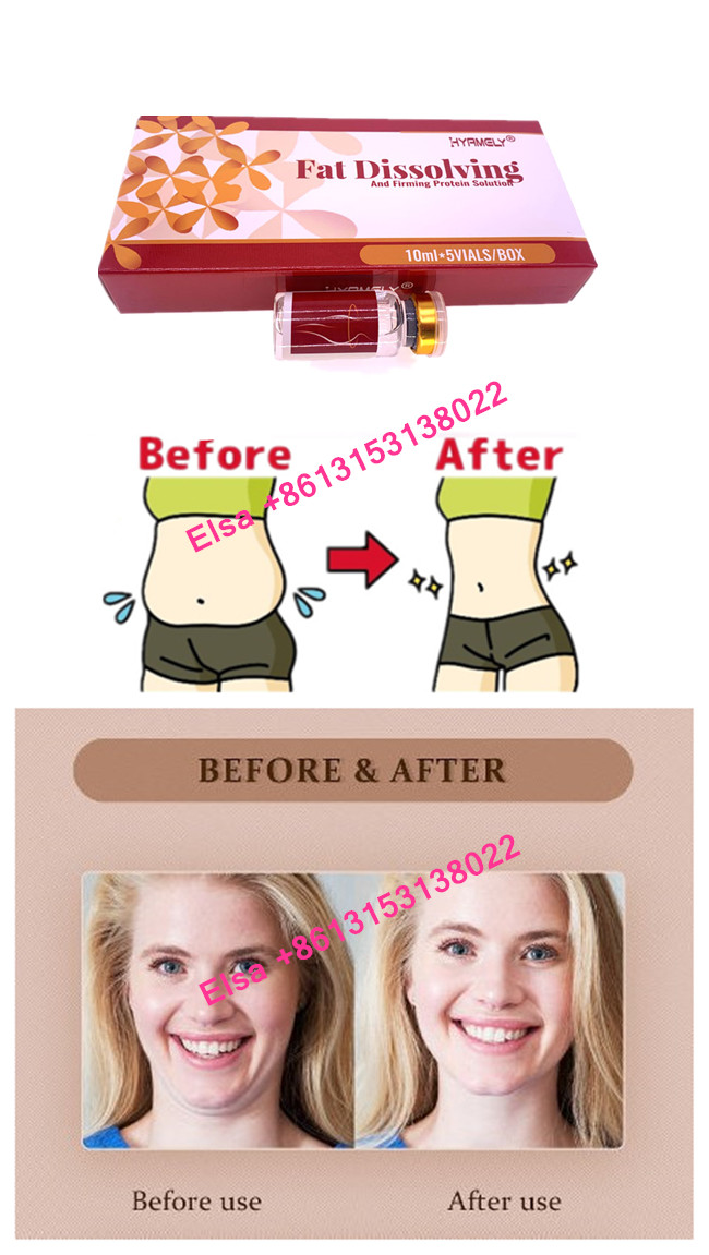 Hyamely Lipolytic Injections Dissolving Fat Product Effective 5×10ml