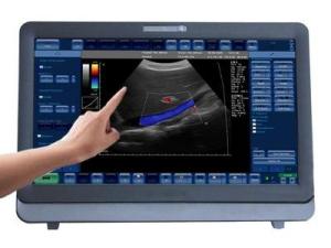 Quality Medical 3D / 4D Color Doppler Ultrasound System Portable With 15 inch LED Monitor wholesale