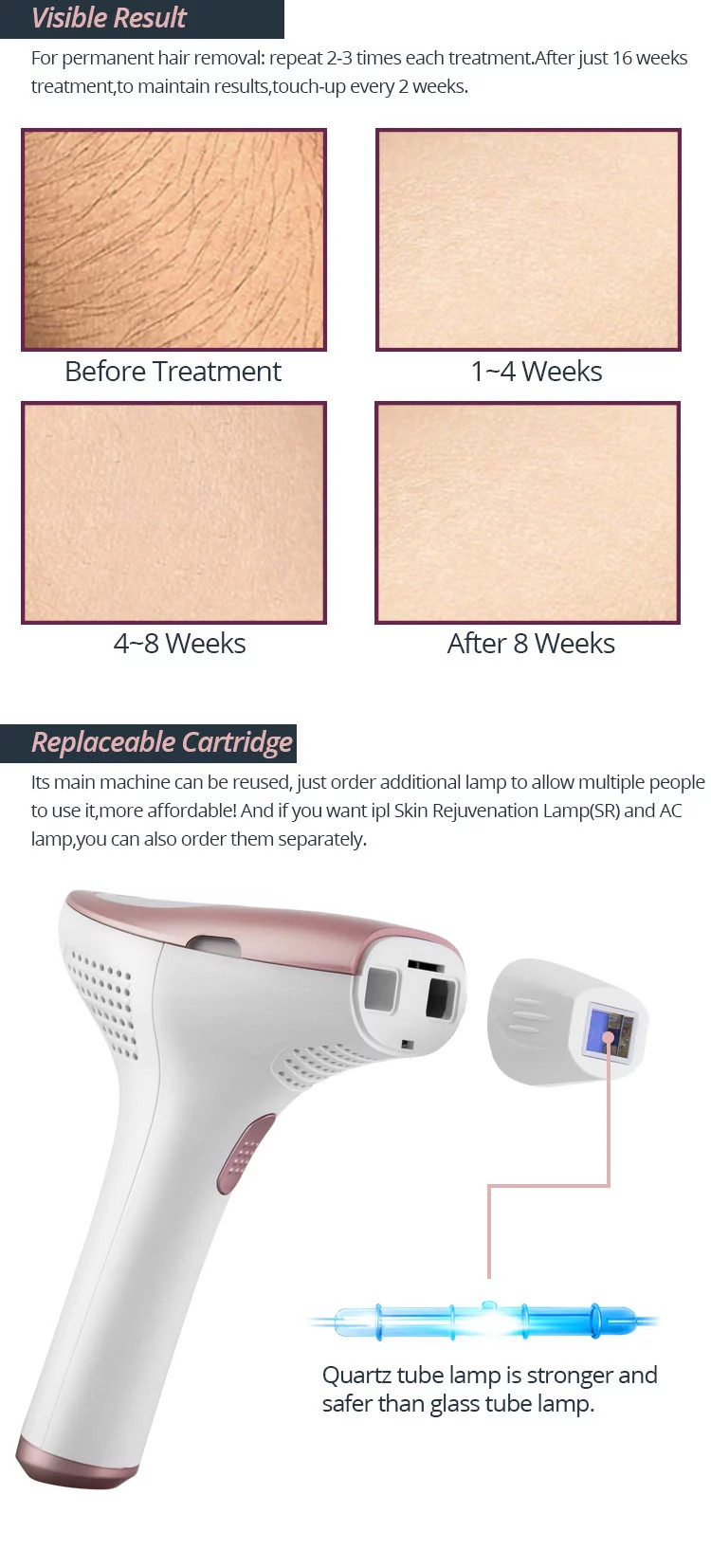 3 In 1 Quartz Lamp AC SR IPL Laser Hair Epilator