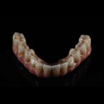 Fixed Restorations Full Arch Zirconia Implant Bridge Denture Teeth