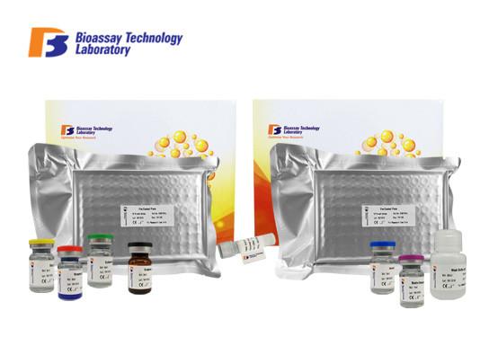 Mouse Ovalbumin Specific Human IgE ELISA Kit / Elisa Diagnostic Kits For