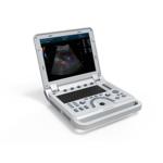 CONTEC CMS600P2 PLUS portable ultrasound machine pseudo color doppler medical