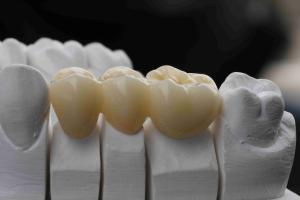 Quality Pre Colored 98*16mm 3D Multilayer Zirconia Block wholesale