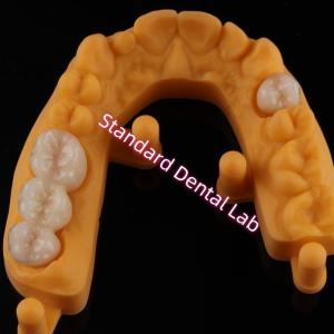 Quality Crown All Porcelain Ceramic Zirconia Ivoclar Esthetic Teeth OEM wholesale
