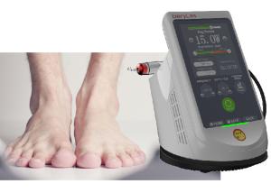 Quality 10W Laser Treatment Machine Toenail Fungus Wart Removal Laser Treatment wholesale