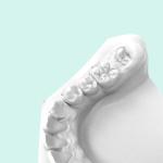 High Temperature Resistant Orthodontic Model Dental Resin 3d Printing