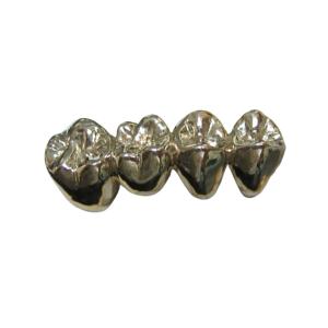 Quality High Stability Semi Precious Dental Crown Bridge PFM Easy Casting wholesale