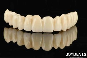 Quality Seamless Gradient Dental PMMA Multilayer Design For Natural Shade Transitions wholesale