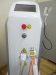 Stationary Diode Laser Hair Removal Machine