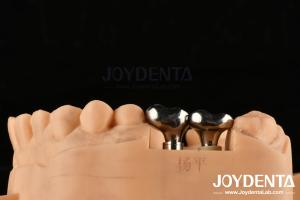 Quality Silver Dental Implant Abutments Customizable Diameter Height CAD CAM Technology wholesale