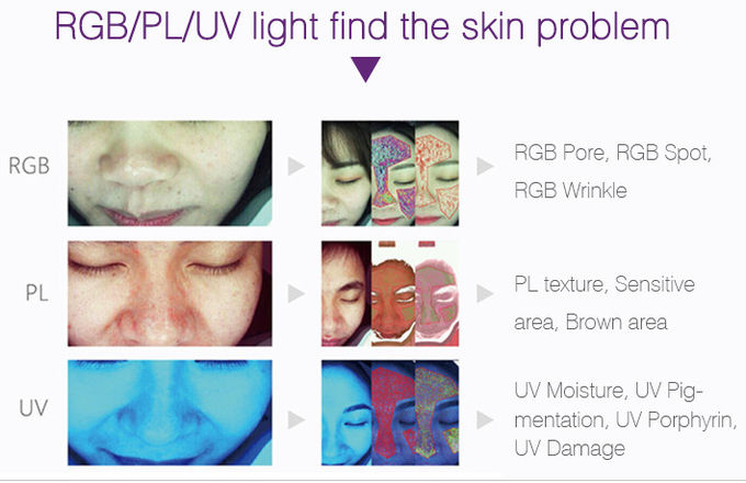 Digital Testing Skin Diagnose Machine for Doctor Cosmetics Clinic