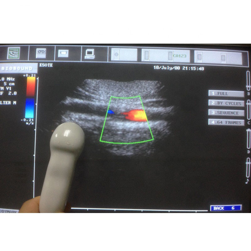 Esaote CA123 Convex Array Ultrasound Scan Probe for MyLab 25 Series