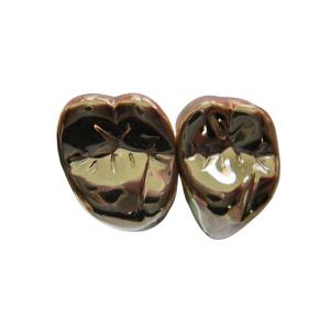 Quality High Strength FMC Metal Crown Tooth Semi Precious Metal Crown wholesale