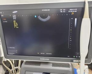 Quality Samsung Medison H60 Intracavity Array Original Ultrasound Probe ER4-9 wholesale