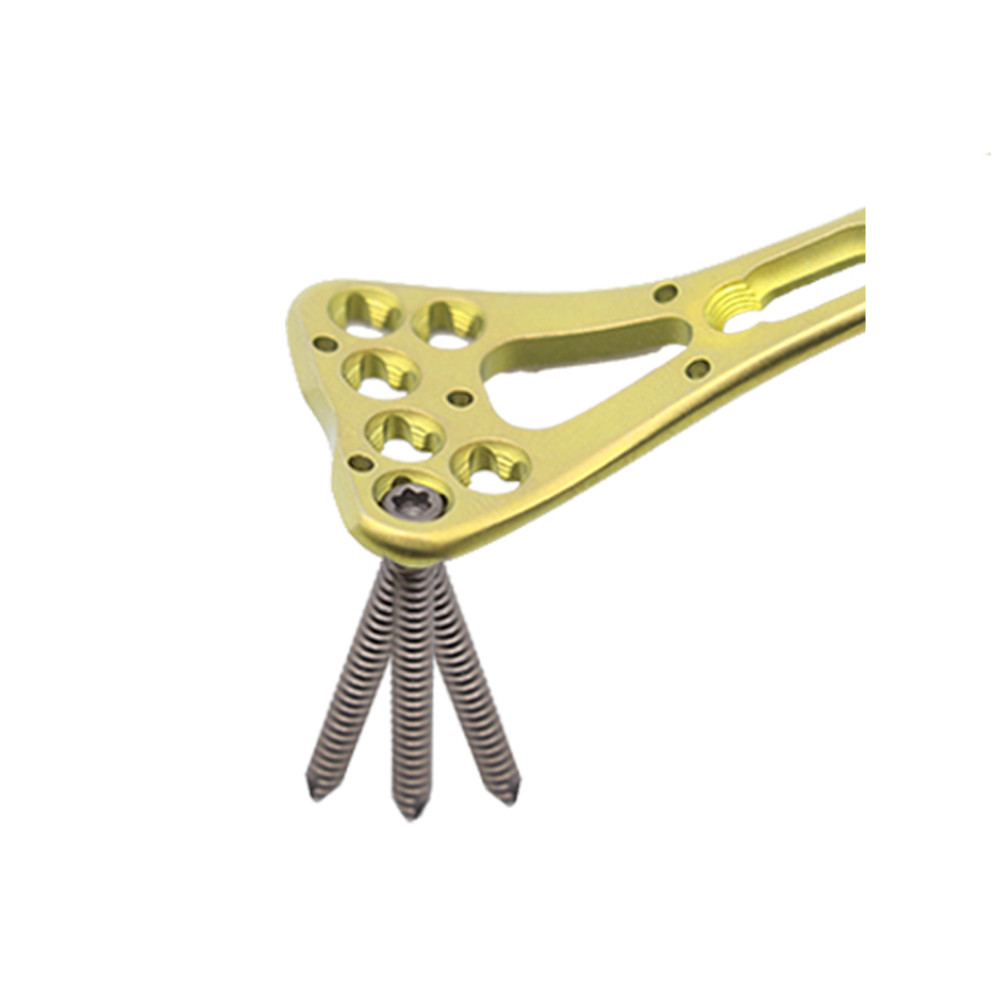 Orthopedic Implants Trauma Plate Distal Radius Multi-Axial Locking Plate