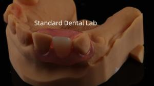 Quality Dental TCS Valplast Flexible Partial Dentures Nesbit Valplast Finish China Dental Lab Valplast Clasp wholesale