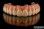 Dental Ti-Bar Hybrid Zirconia Bridge Excellent Strength Restores Chewing