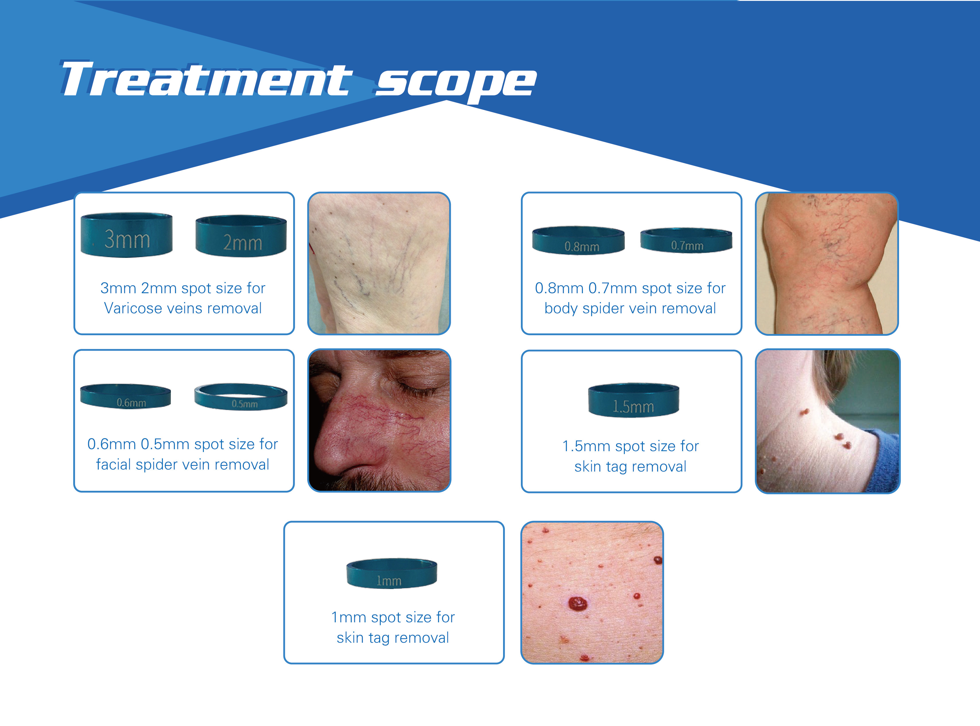 laser varicose vein removal treatment 980nm laser vascular removal machine portable
