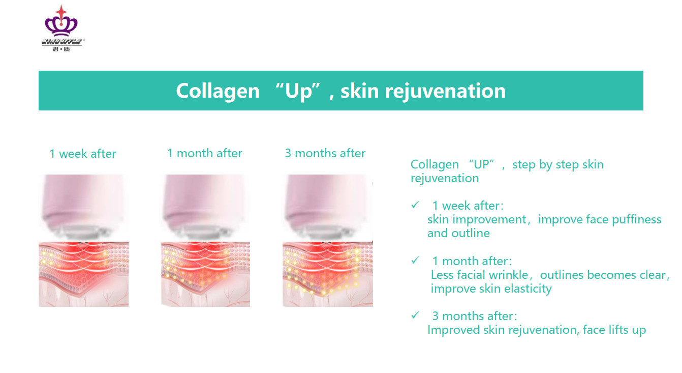 5V Cordless CE Anti Wrinkle RF Beauty Instrument