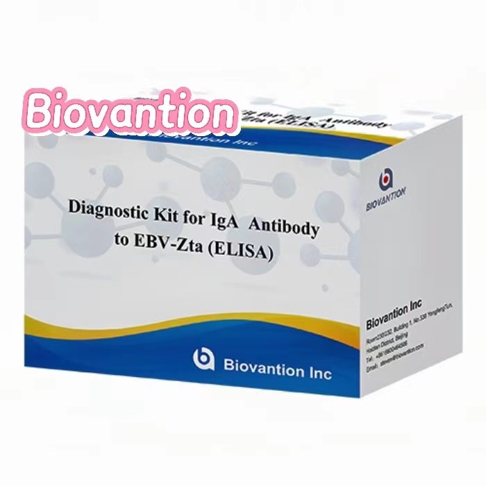 Diagnostic Kit For IgA Antibody To EBV-Zta ELISA TEST KIT Immunosorbent Assay Test Kit