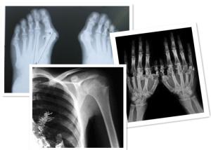 Quality Thermal Digital X Ray Film Fuji Medical For Radiography Examination wholesale