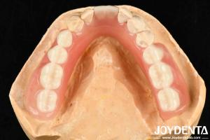 Quality Diverse And Lightweight Resin Material Acrylic Denture Finish wholesale