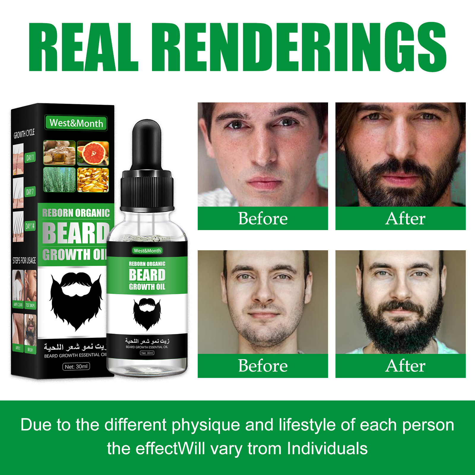 100% Natural Beard Growth Oil For Men Abeis OEM ODM Professional Daily Beard Care