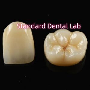 Quality Biocompatible Material Aesthetic Zirconia Crown Zirconia Bridge Teeth wholesale