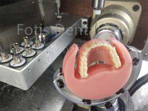 Quality Ivoclar Natural Color Full Acrylic Denture Comfort Fit Prosthesis With Esthetics wholesale