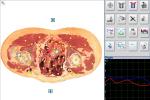 Health Care Products Metatron NLS Body Analyzer Herbal Treatment Equipment for