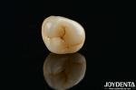 Dental Multilayer Full Zirconia Crowns And Bridges High Translucent Natural