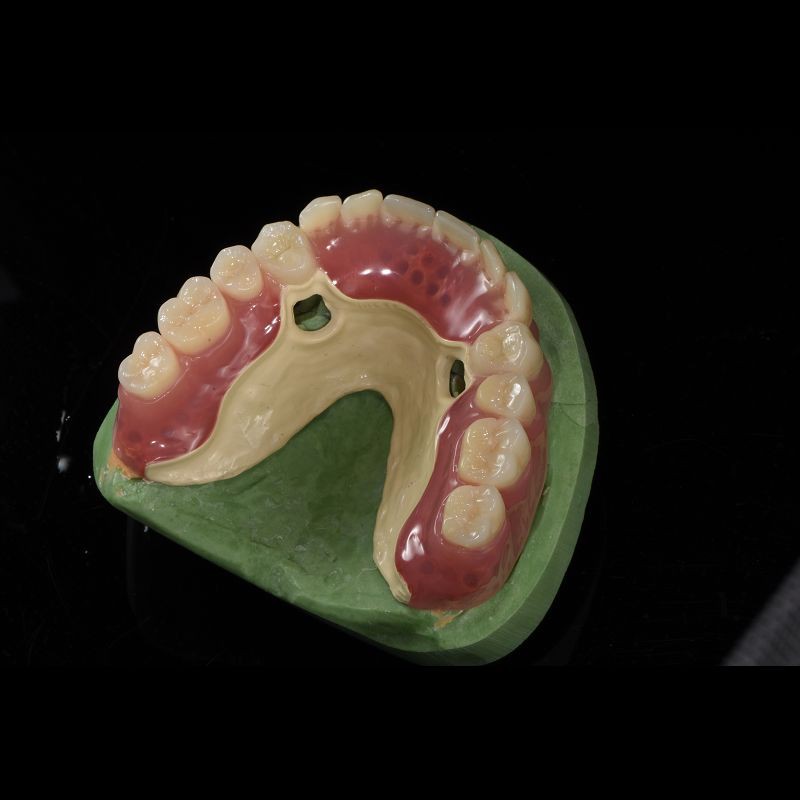 OEM Peek Cast Metal Framework Partial Denture User Friendly