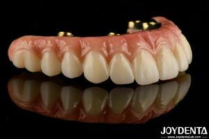 Quality Custom-made For Each Patient Ti-Bar Zirconia Hybrid Bridge For Long-lasting Dental Prosthesis wholesale