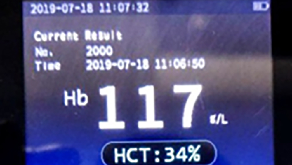 H7-5 POCT black color multi-function blood hemoglobin analyzer