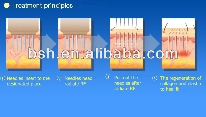 Portable Radio Frequency Face Lift Device Radio Frequency Instrument ABS Material