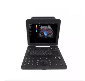 Quality Cardiovascular Cardiology Portable Full Figital Color Doppler Ultrasound Scanner Machine wholesale