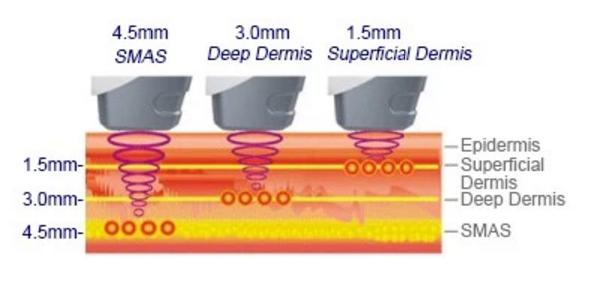 Vertical 5 Cartridges HIFU Beauty Machine For Face Lifting / Wrinkle Removal