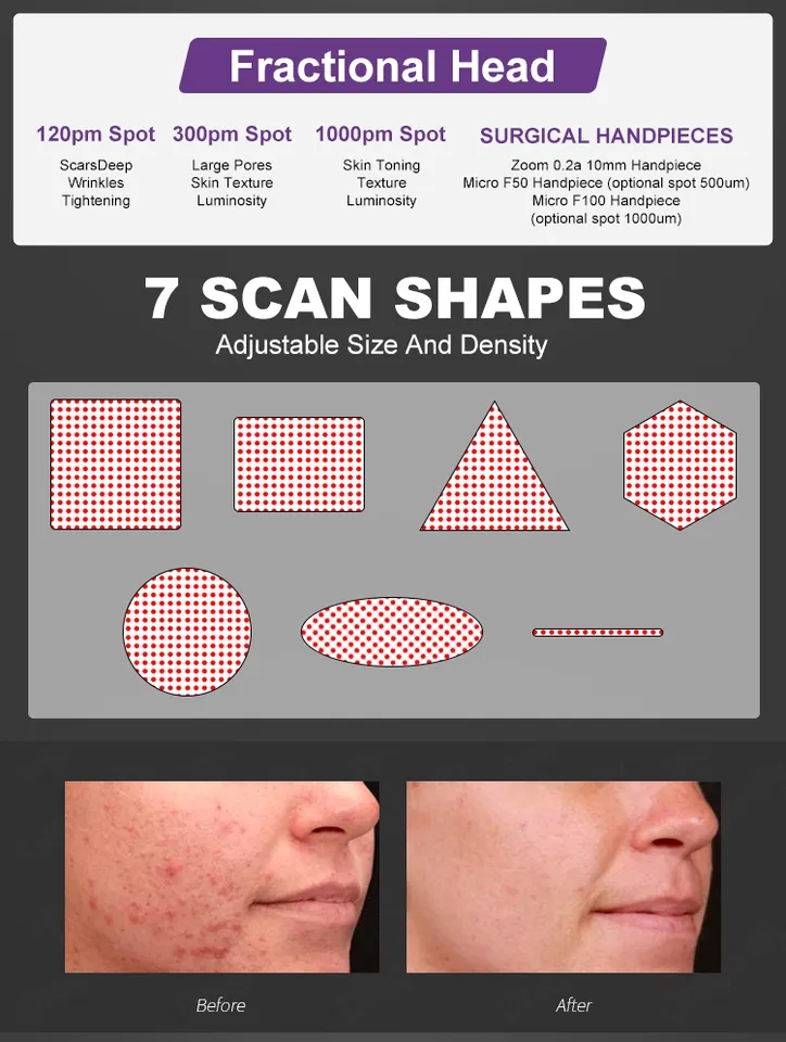 1060nm Fractional CO2 laser Machine Portable CO2 Laser Skin Resurfacing Machine 4000w