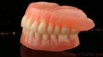 Heat Cured Ivoclar Full Acrylic Denture Dental Lab High Accuracy High Esthetic