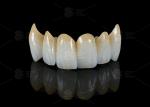 High Translucency Full Contour Zirconia Bridge Chipping Resistance Natural