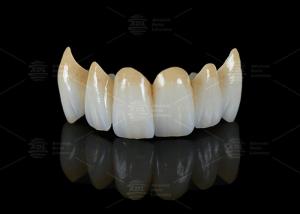 Quality High Translucency Full Contour Zirconia Bridge Chipping Resistance Natural Esthetics wholesale