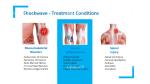 The Power of Shockwave Therapy Rapid Chronic Pain Relief Machine