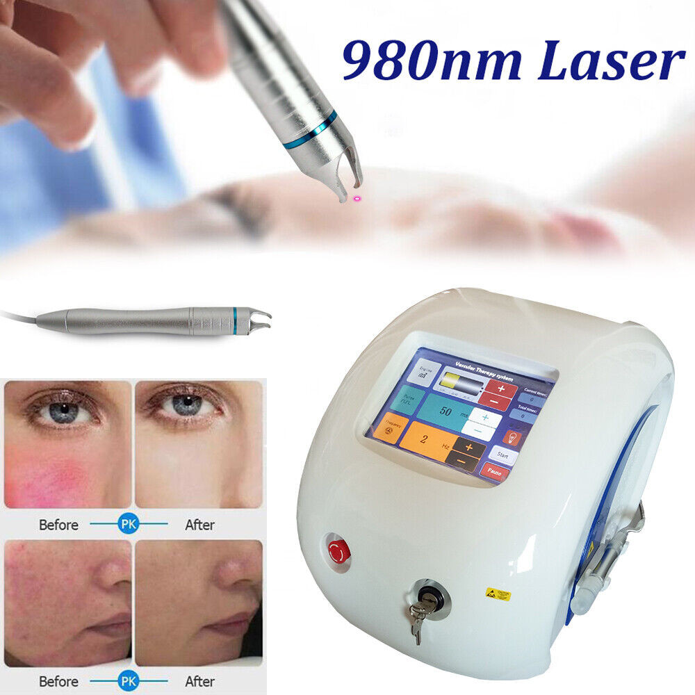 Professional 30W Laser Beauty Machine 980nm Diode Laser Spider Vascular Vein Removal