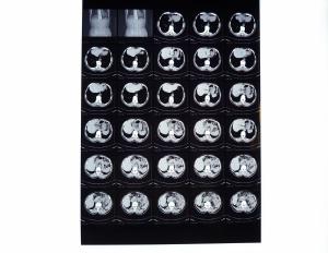 Quality Drypix 2000 X Ray Dry Film 8 x 10 Inch Scrach Resistant For Fuji 3000 wholesale