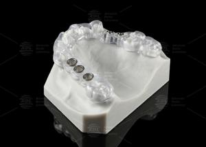 Quality Custom Made Transparent Dental Implant Solution Surgical Stent Ergonomic Design wholesale