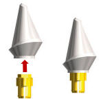 Nobel Biocare Replace® Titanium Temporary Abutment Compatible with NP 3.5mm/ RP 4.3mm/ WP 5.0mm(Engaging & Non-Engaging