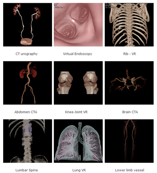 16 Dual - Slice Refurbished Used CT Scanner System from China