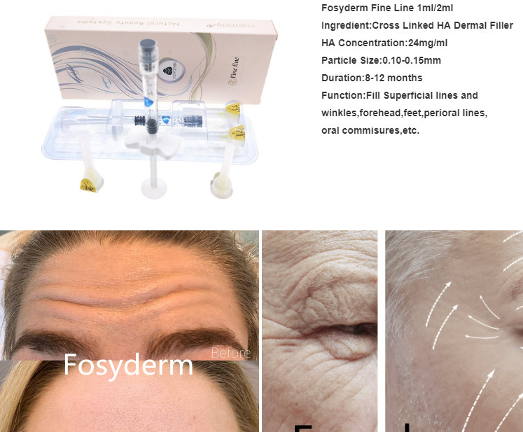 Transparent HA Injectable Volume Hyaluronic Dermal Filler For Face With Syringe
